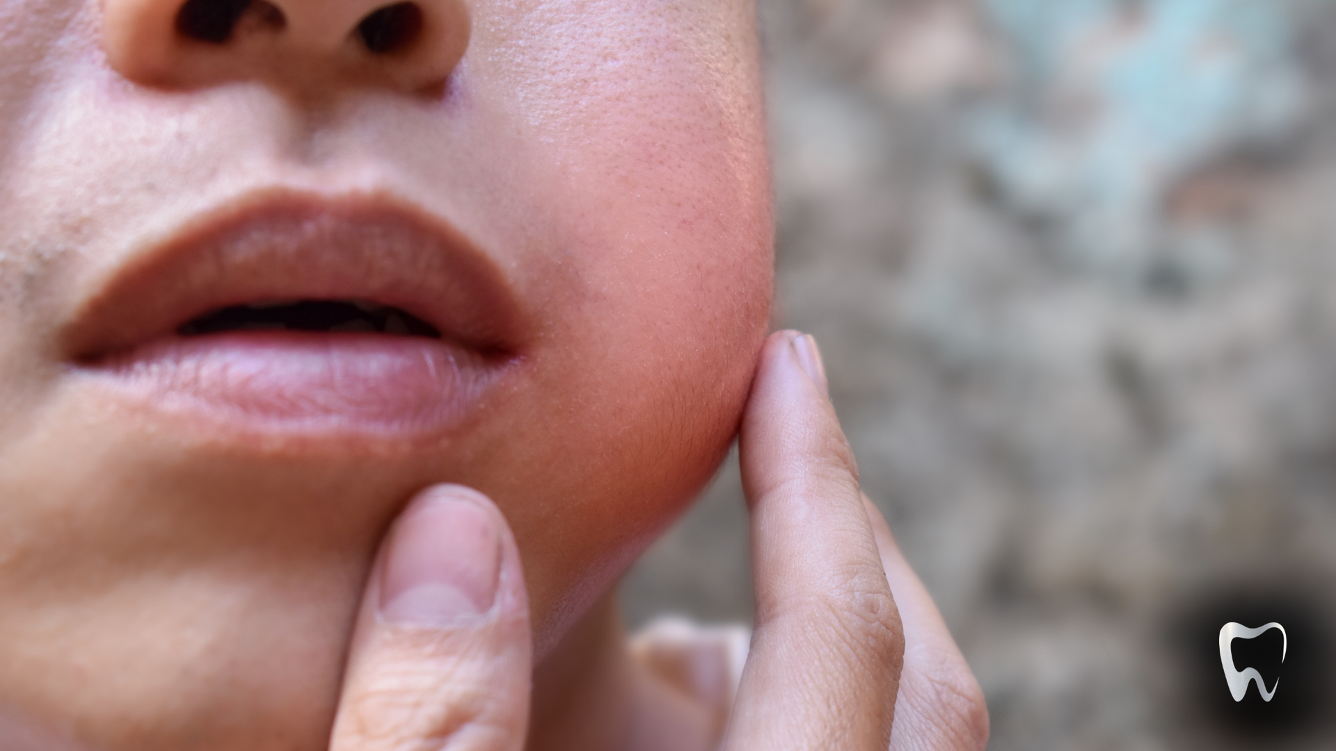 A close up of a person 's face with a tooth in the corner