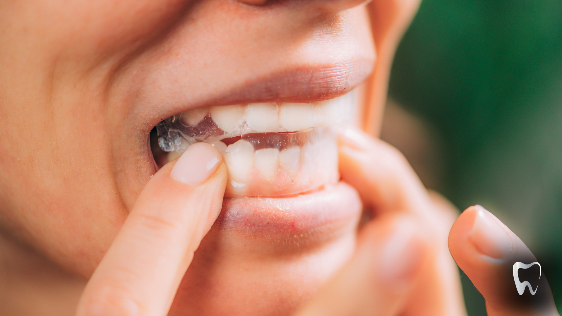A woman is putting a clear brace on her teeth.