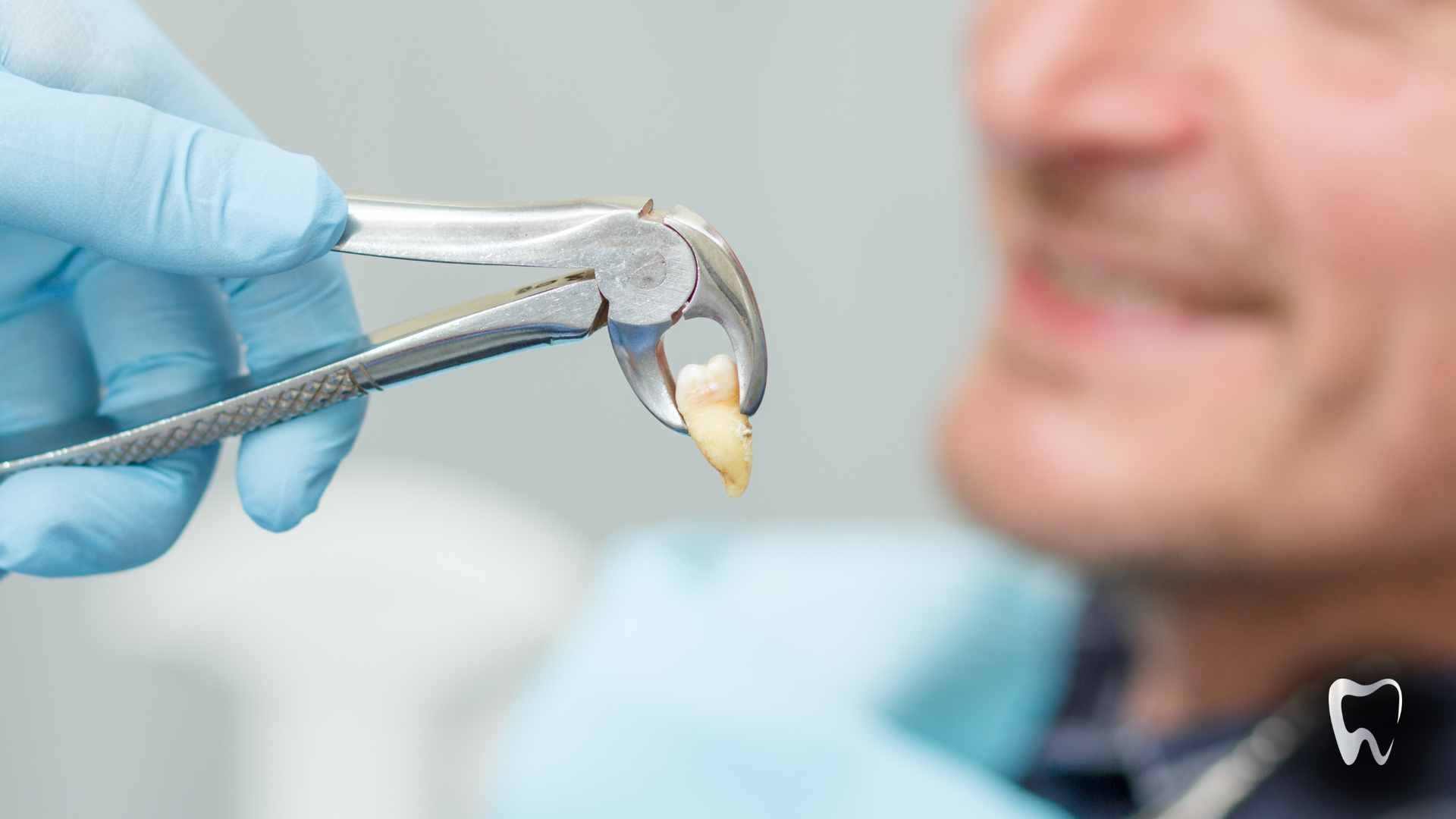 A dentist is removing a tooth from a patient 's mouth with a pair of pliers.