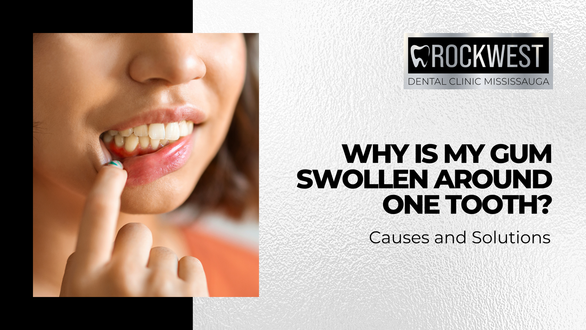 Why is my gum swollen around one tooth ? causes and solutions