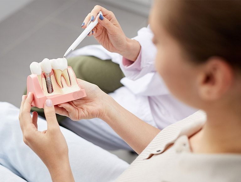 A woman is holding a model of dental implants in her hands.