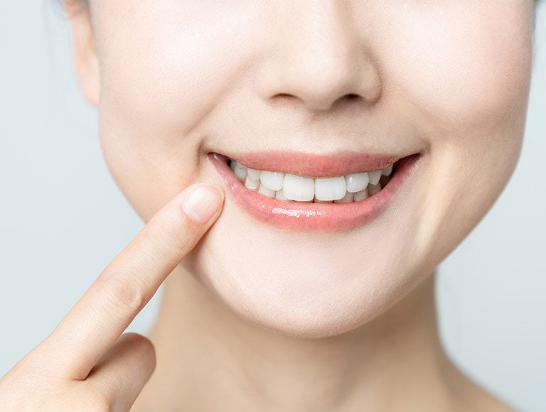 A woman is smiling and pointing at her teeth.