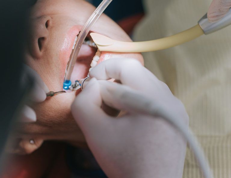 A person is getting their teeth examined by a dentist.