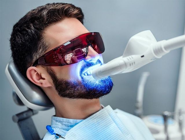 Professional teeth whitening