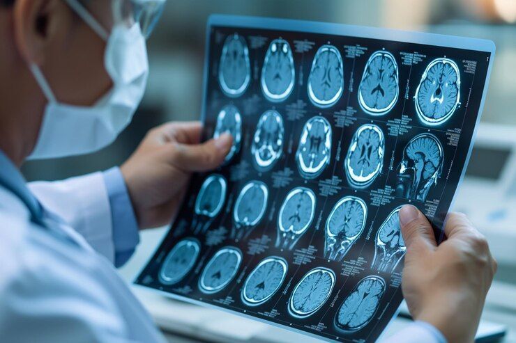 Neurocirurgião especialista em Crânio em São Luís