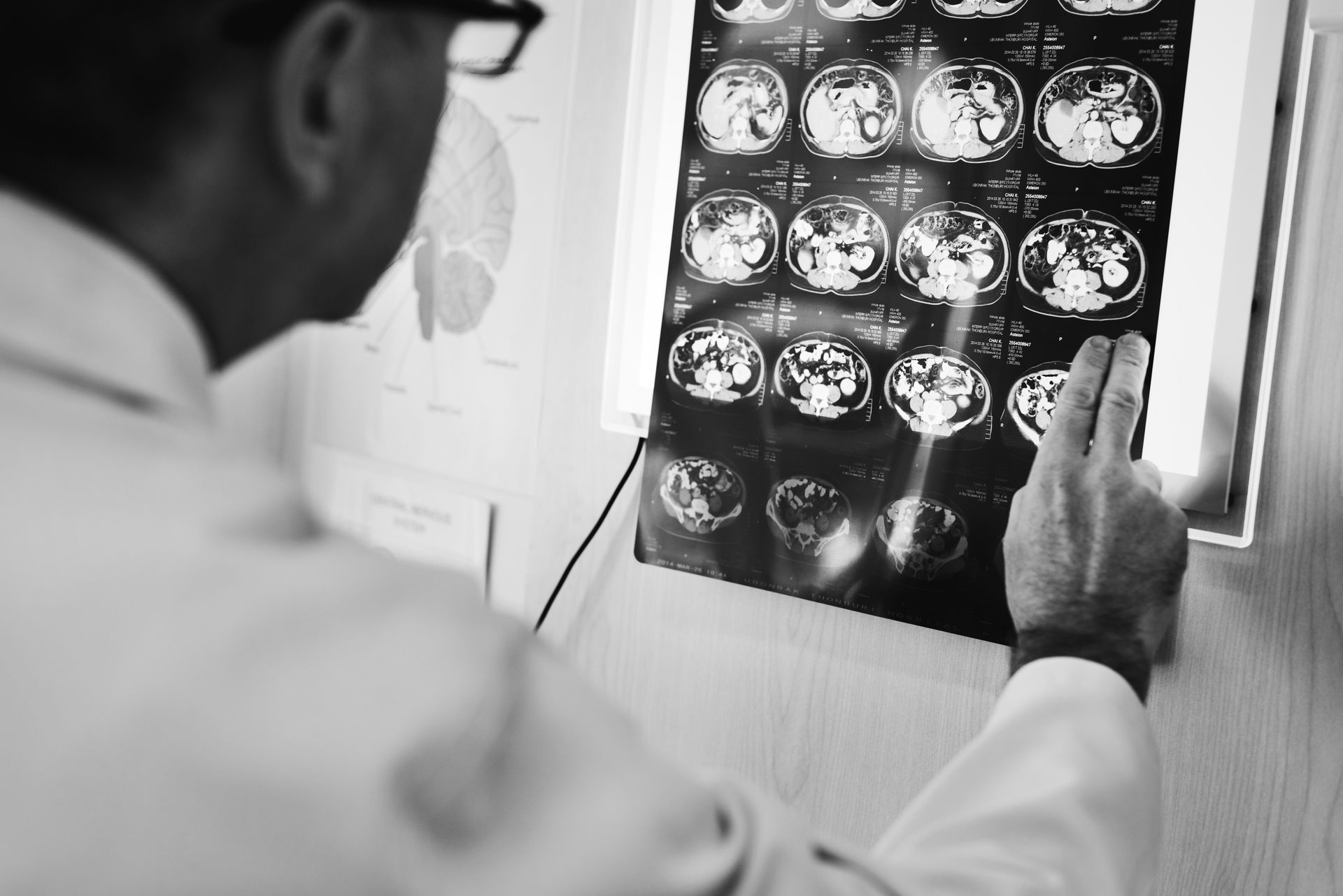 médico de nervos periféricos em São Luís