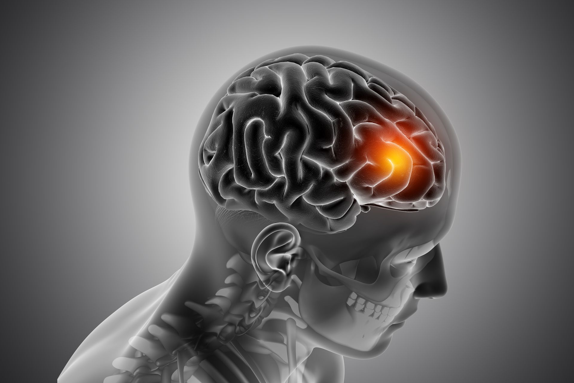 Neurocirurgião especialista em Crânio em São Luís