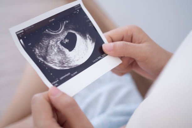 A person is holding an ultrasound of a baby in their hands.