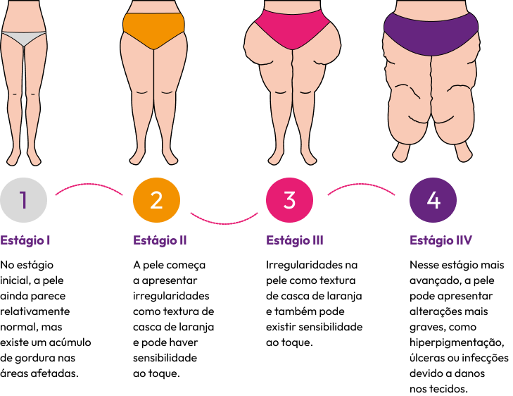 Um diagrama que mostra as fases da gravidez de uma mulher