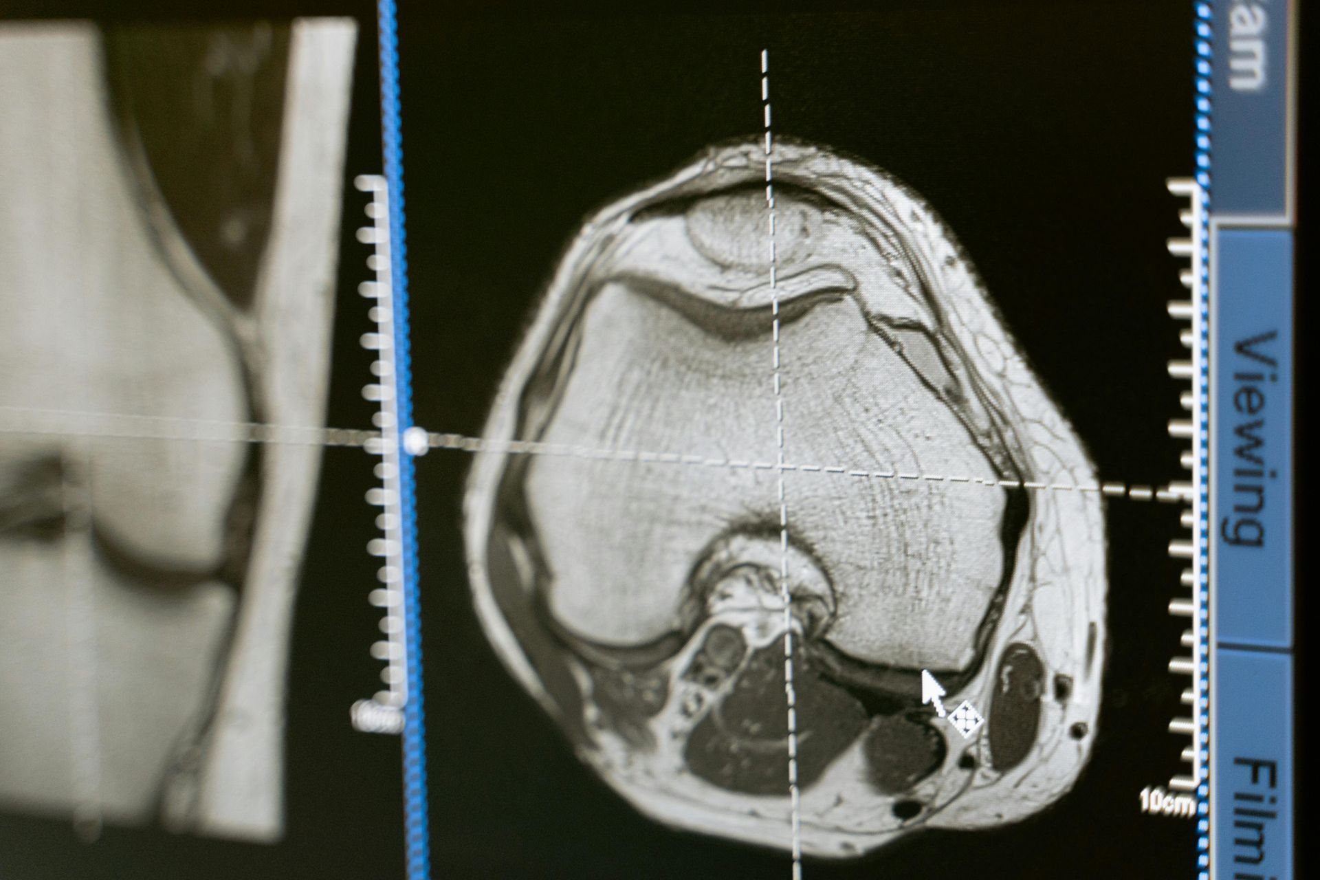 Radiology image of a brain scan.