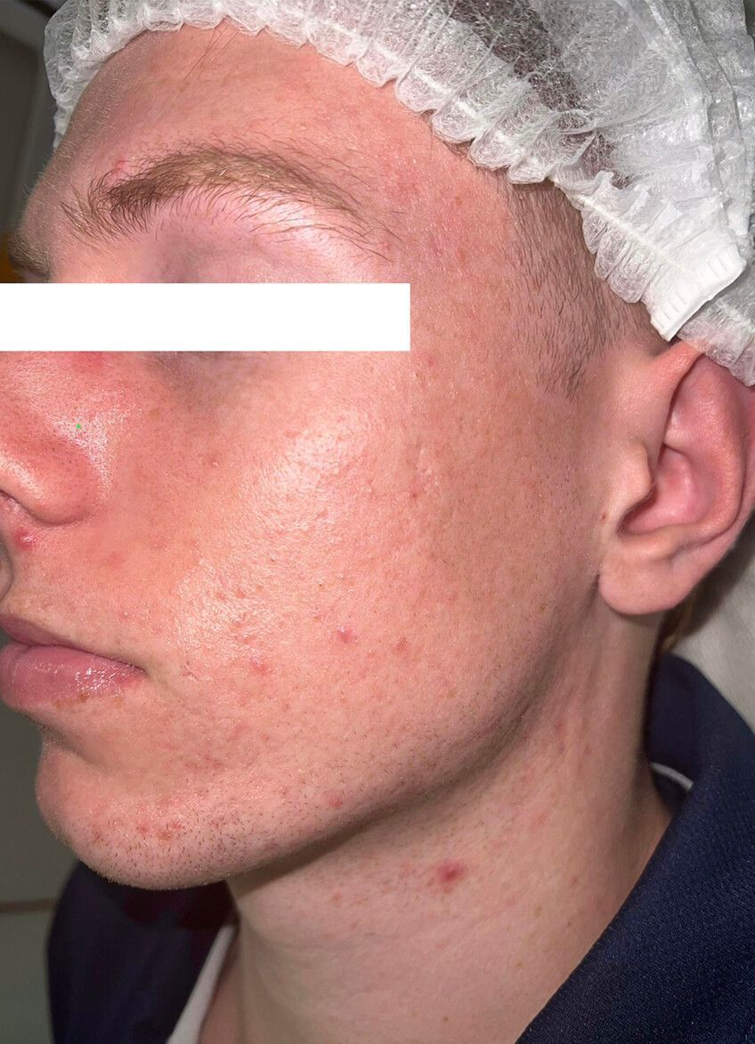 A close up of a man 's face with a white hat on.