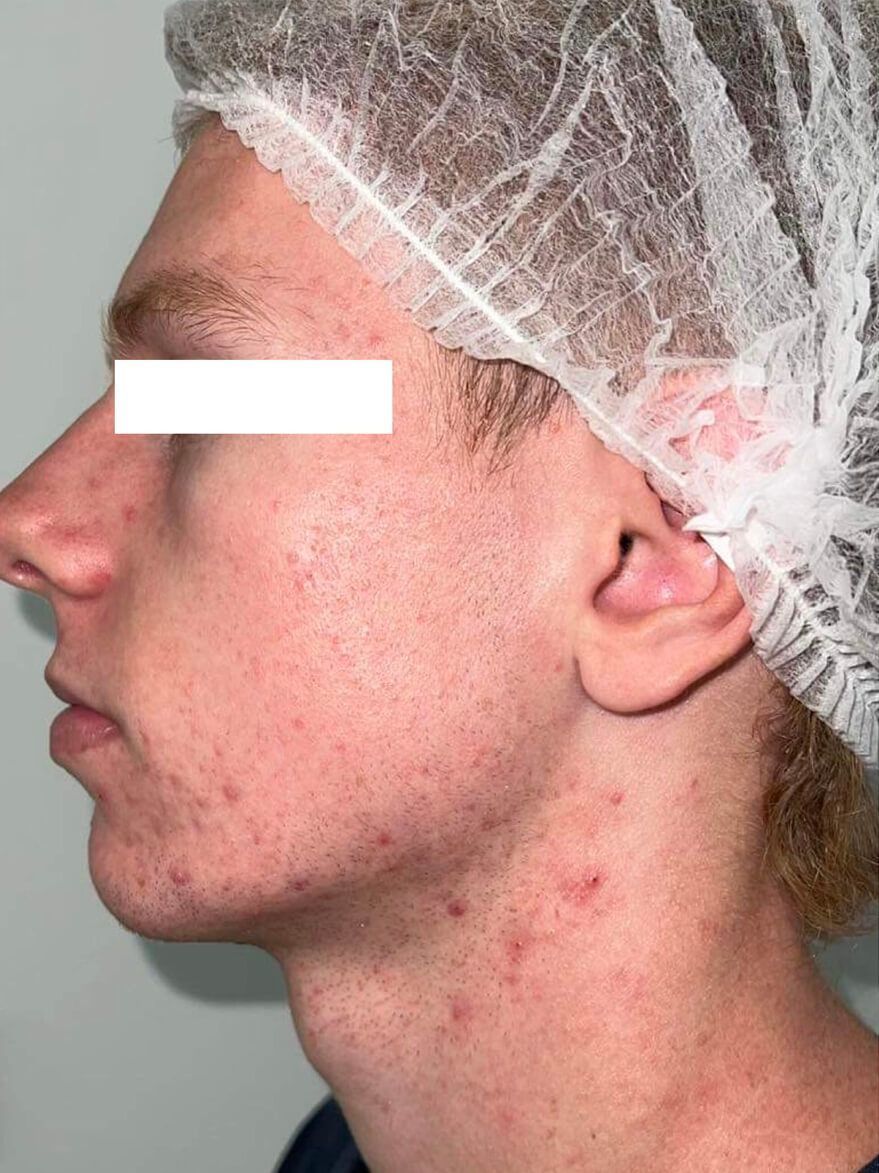 A close up of a man 's face wearing a surgical cap.