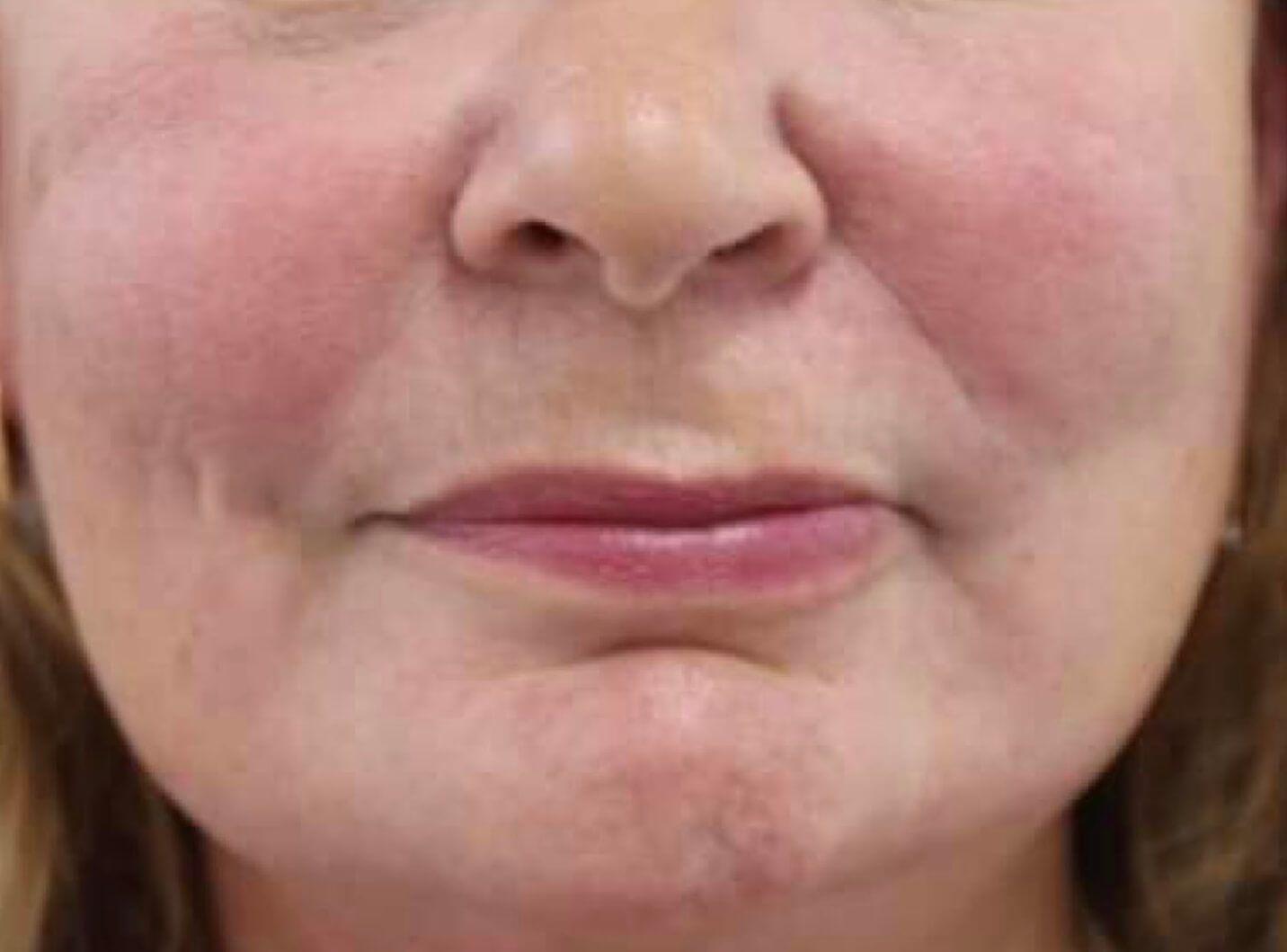 A close up of a woman 's face with red cheeks.