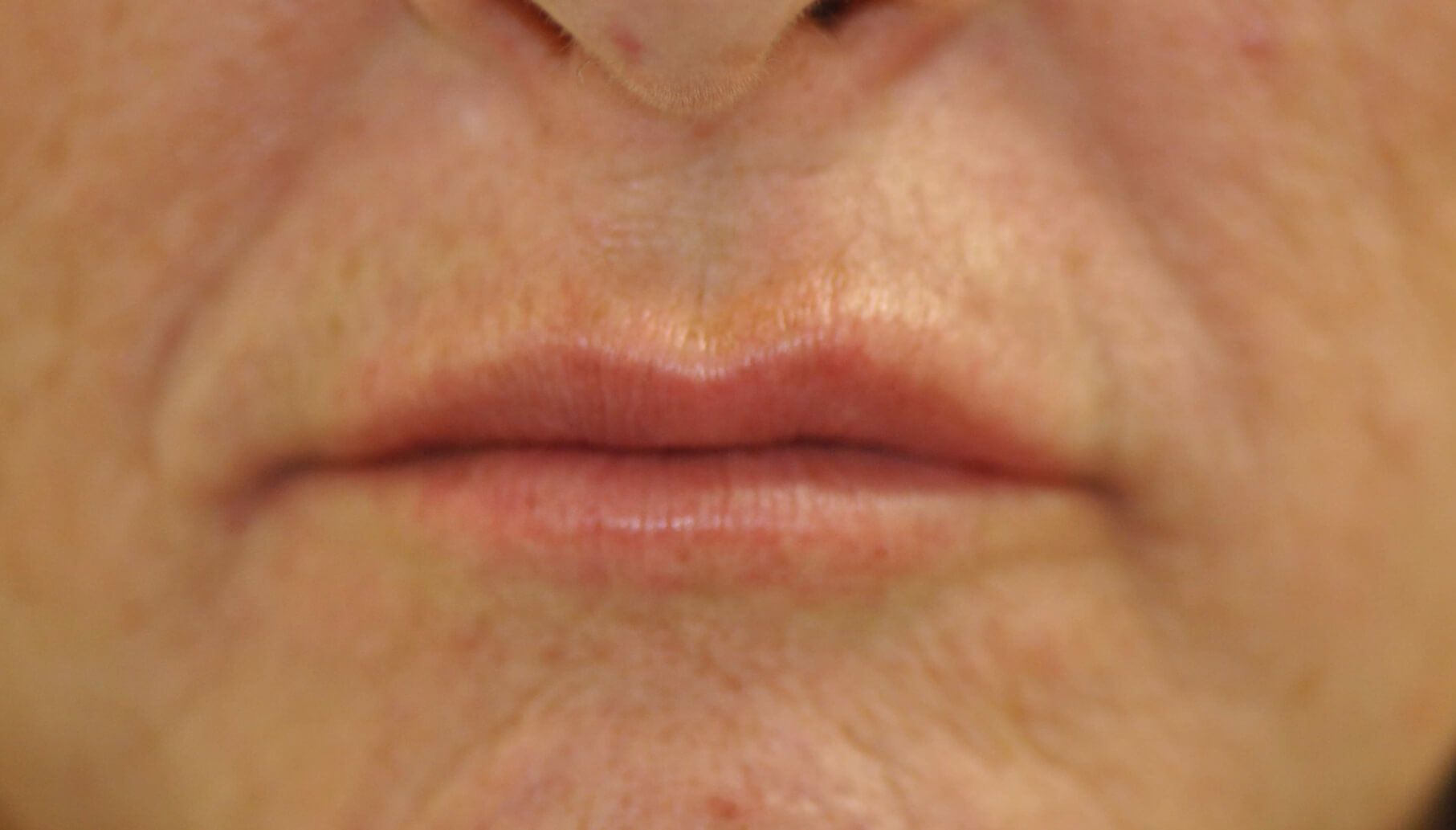 A close up of a woman 's lips with wrinkles.