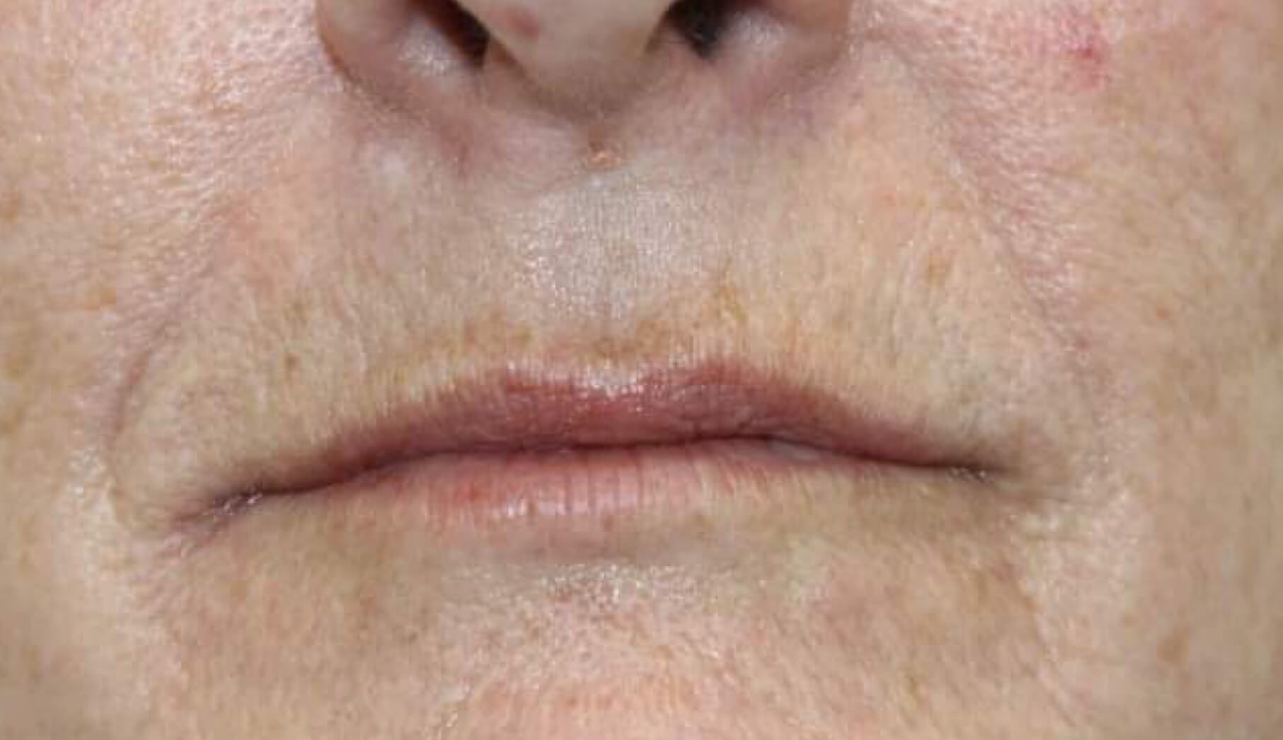 A close up of a woman 's face with wrinkles and a nose.