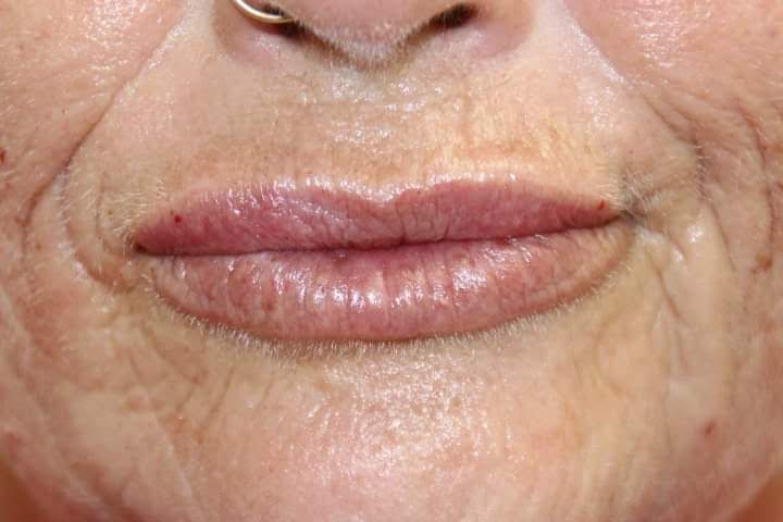 A close up of an older woman 's lips with a nose ring.