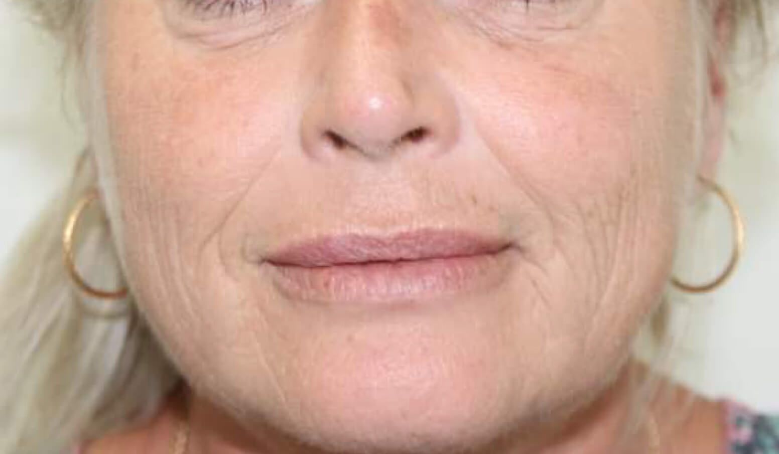 A close up of a woman 's face with wrinkles and earrings.