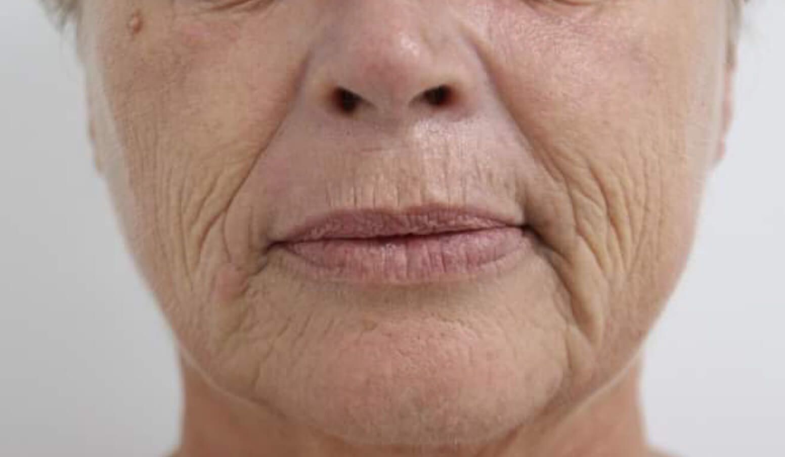 A close up of an older woman 's face with wrinkles.