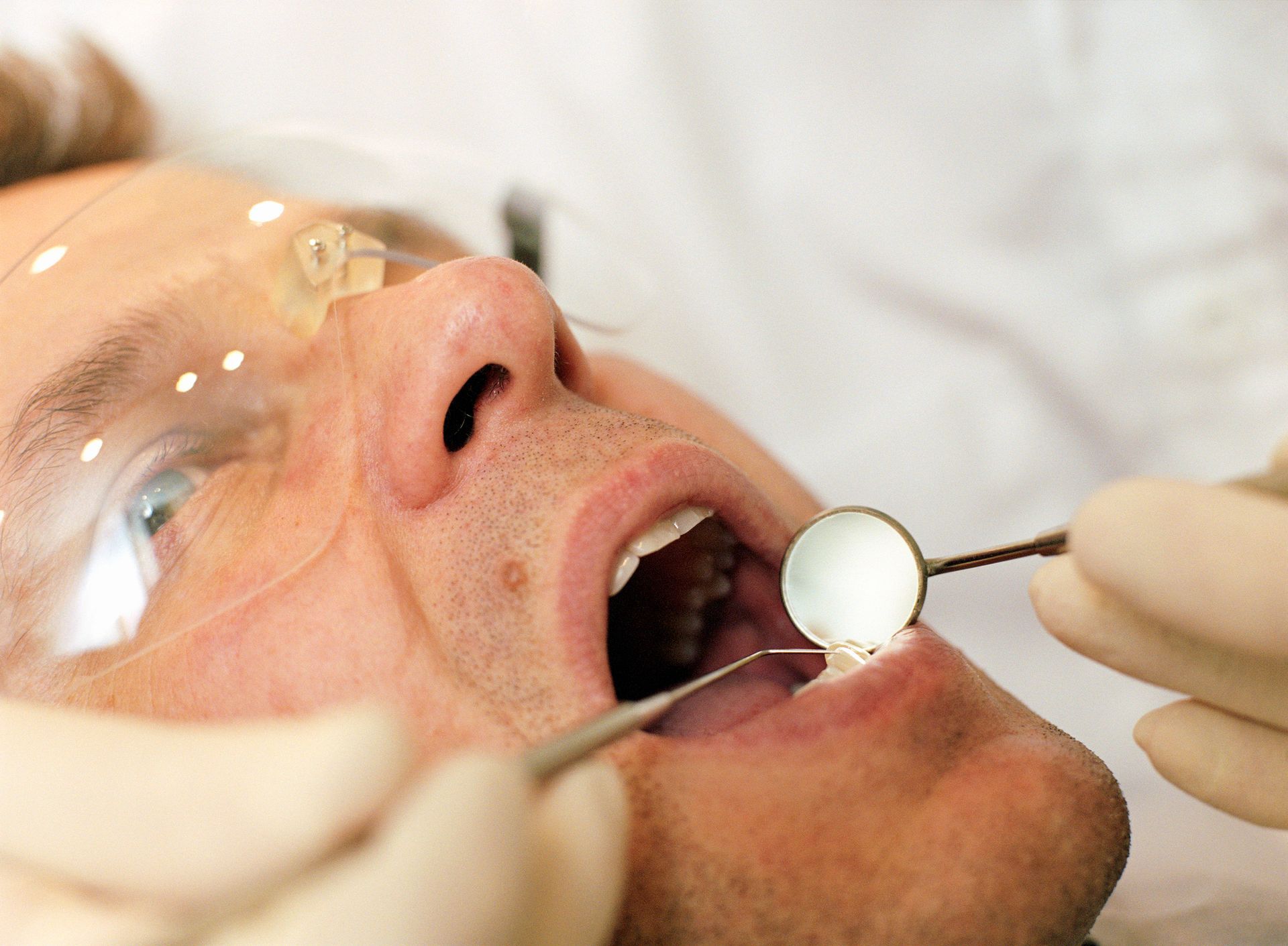 Dental exam with mirror and tool during professional oral checkup at a dental clinic.