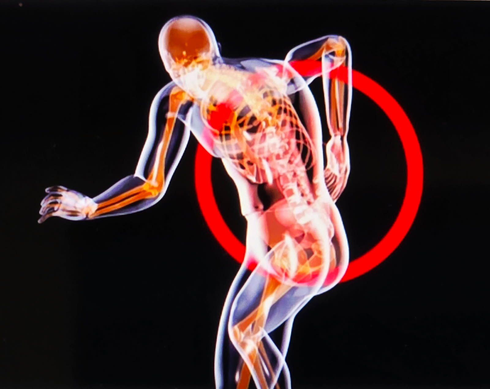 X-ray view of a person with a highlighted back injury, indicated by a red circle.