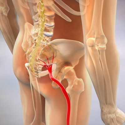 Diagram of human anatomy, highlighting the sciatic nerve in red, and the spinal cord in yellow.
