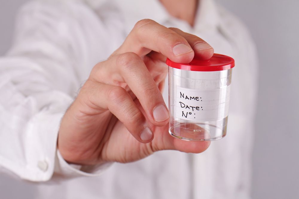 Person in Lab Coat Holding a Labelled Urine Sample Container — DAB Services in Bendigo, QLD