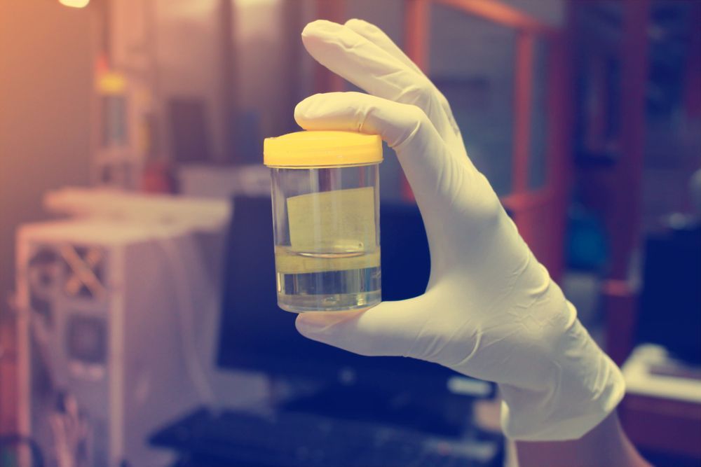 Gloved Hand Holding a Urine Sample in a Clear Container With a Yellow — DAB Services in Mackay, QLD