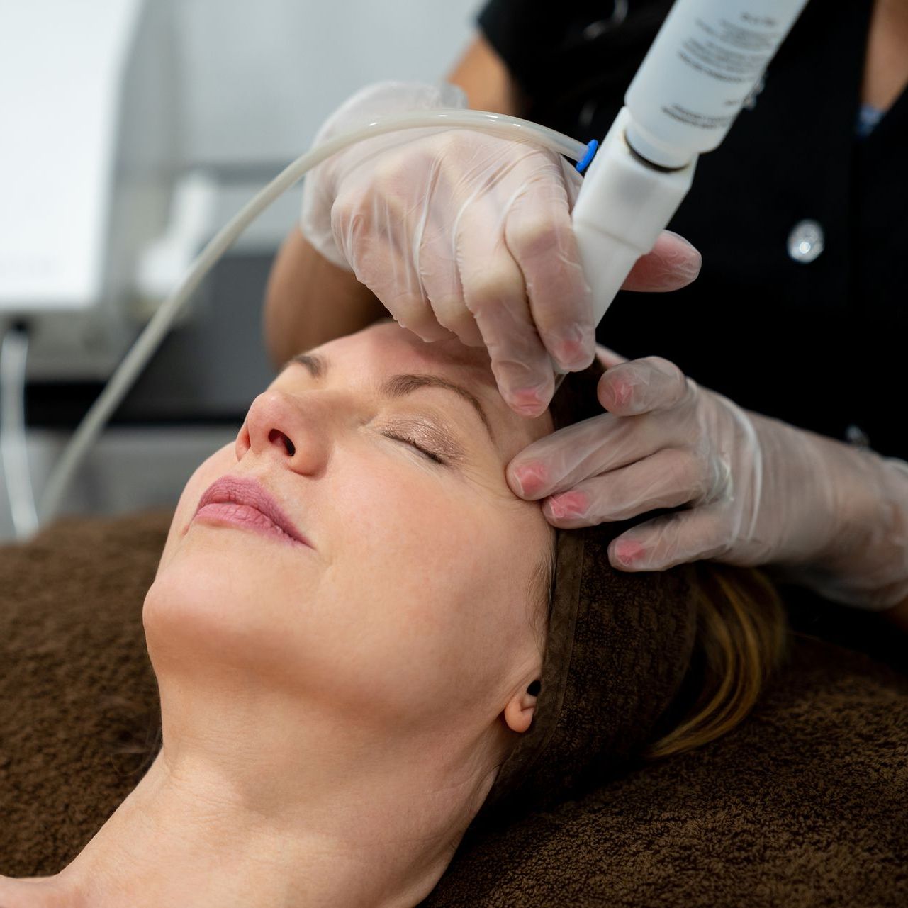Cosmetic Laser Fotona Therapy-The Smile and Face Company-Savannah, GA