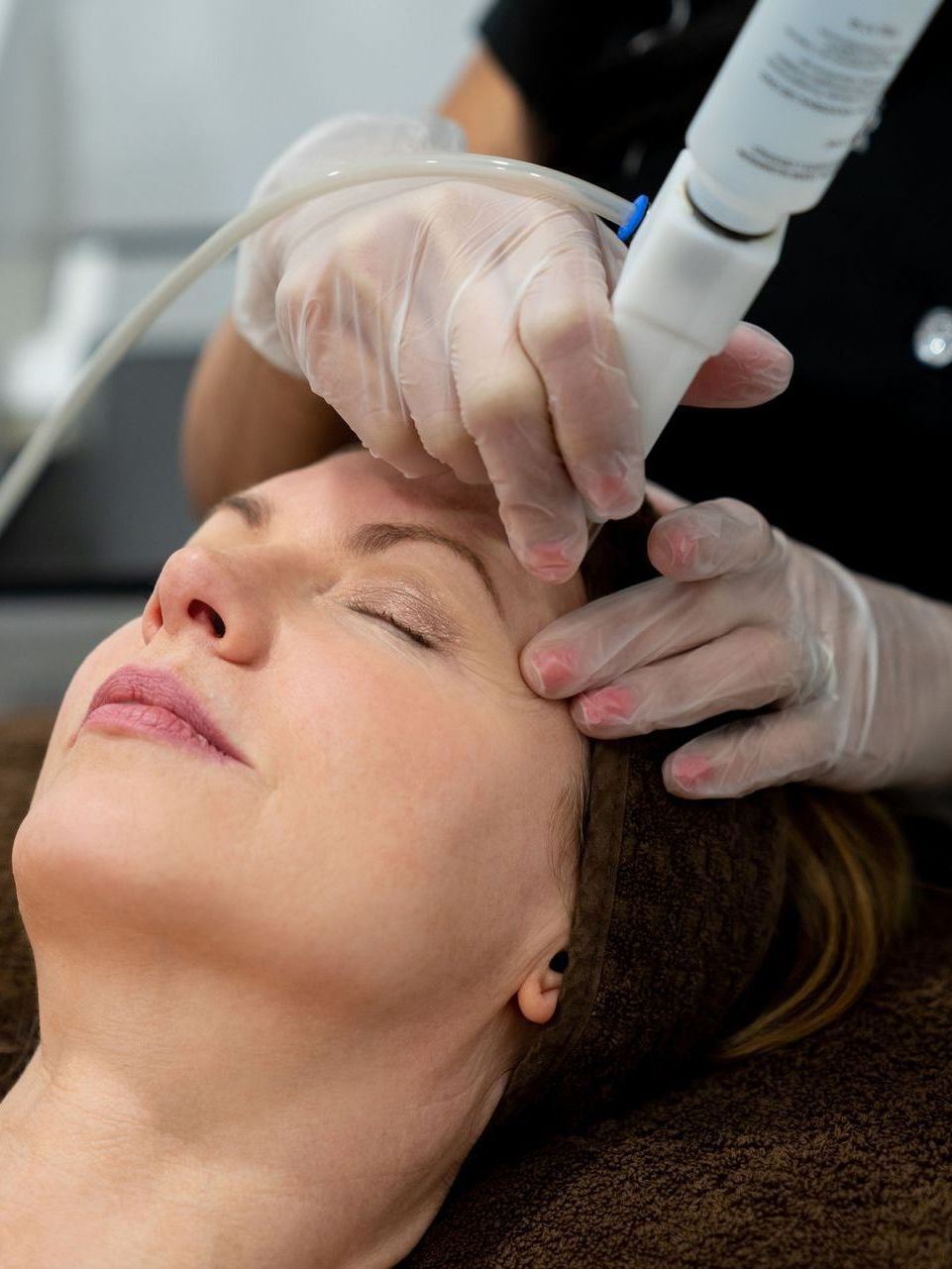 Cosmetic Laser Fotona Therapy-The Smile and Face Company-Savannah, GA
