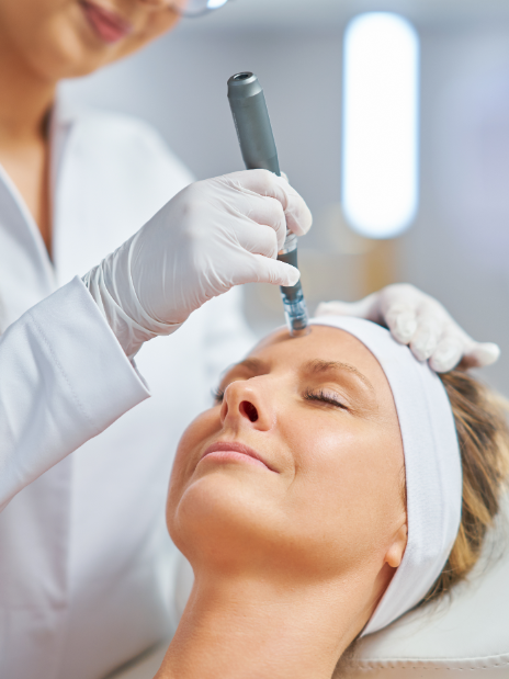 Microneedling Treatment on Forehead-The Smile and Face Company-Savannah, GA