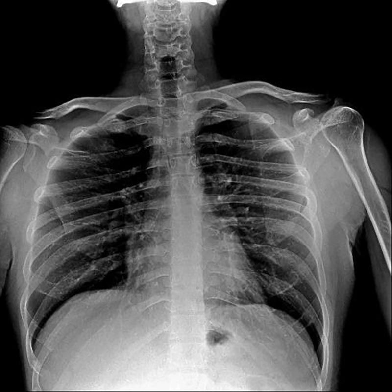 IGM DIGITAL RADIOLOGY