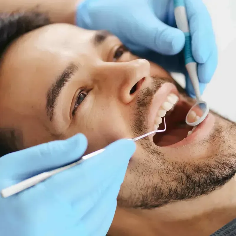 What Causes Periodontal Disease?