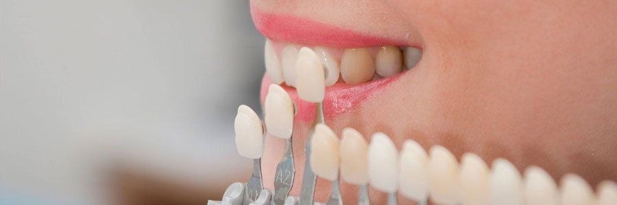 Prosthodontics & Full Mouth Rehabilitation