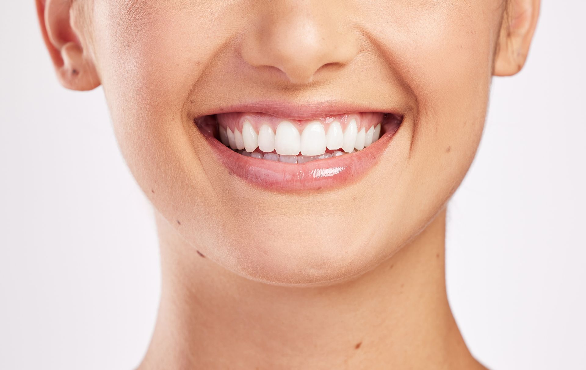 A close up of a woman 's smile with white teeth.