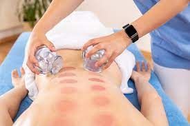 Massage Therapist performing a cupping technique 