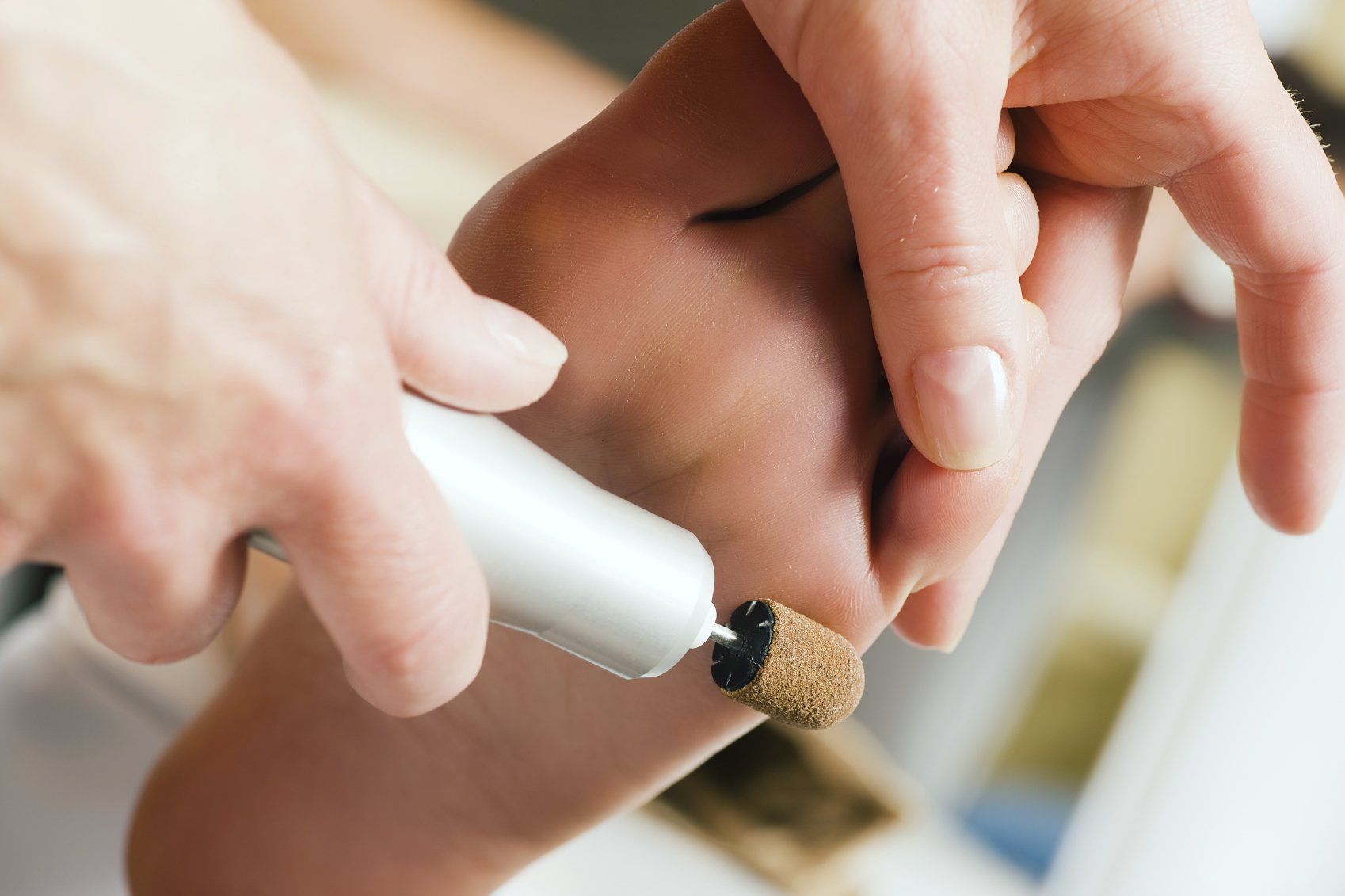 craig boulton podiatry corn and callus removal