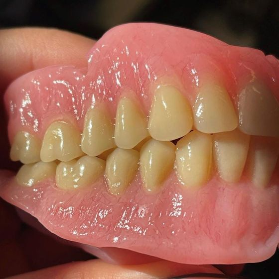 A person is holding a pink denture with yellow teeth