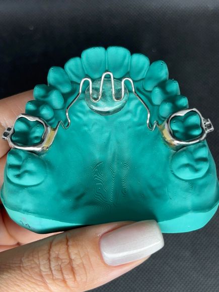 A person is holding a model of a tooth with braces on it