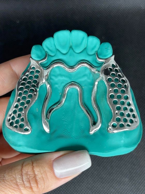 A person is holding a dental model in their hand