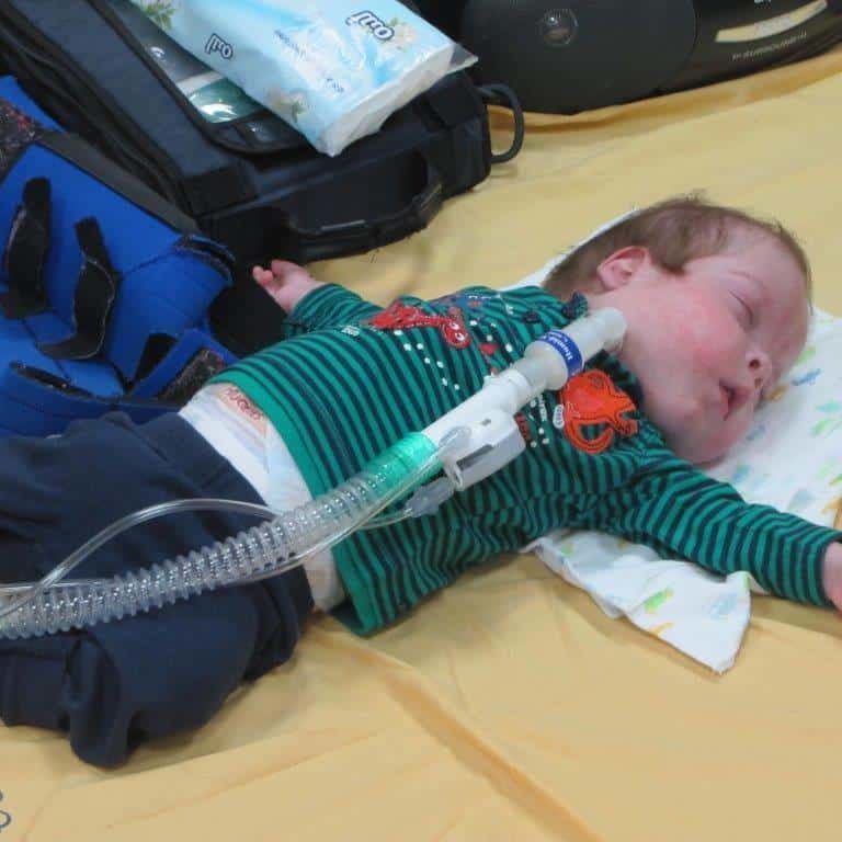 A baby is laying on a bed with an oxygen mask attached to his neck