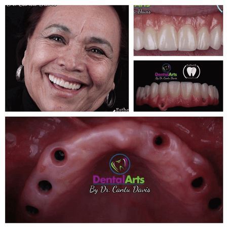 DENTAL ARTS