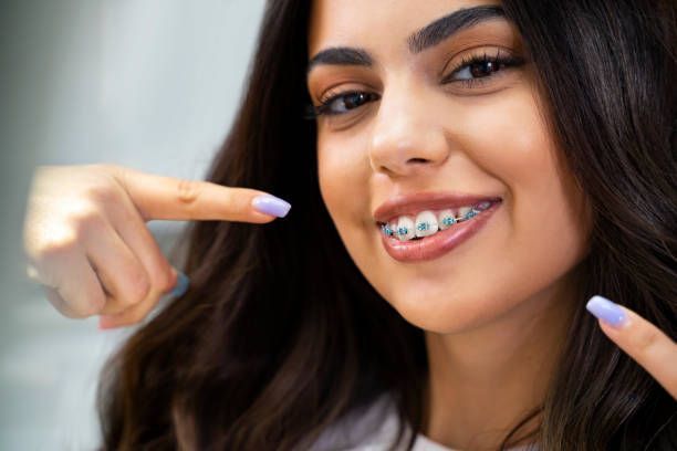 Woman With Braces — Ventura, CA — Surfside Dental