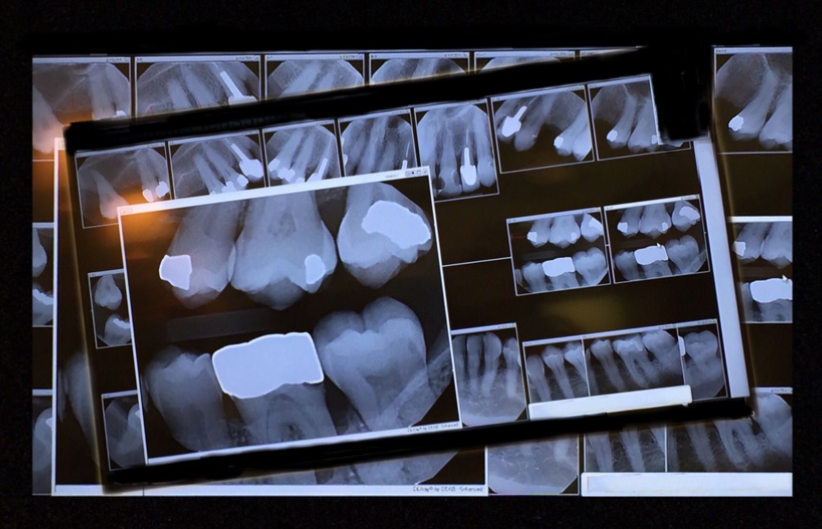 Digital X-rays — Newark, DE — Progressive Dental Arts Christiana