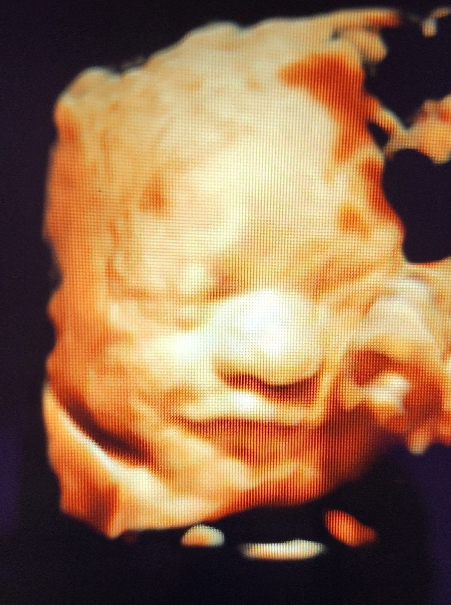 Smilling Baby — Middletown, NY — LAFS Ultrasound
