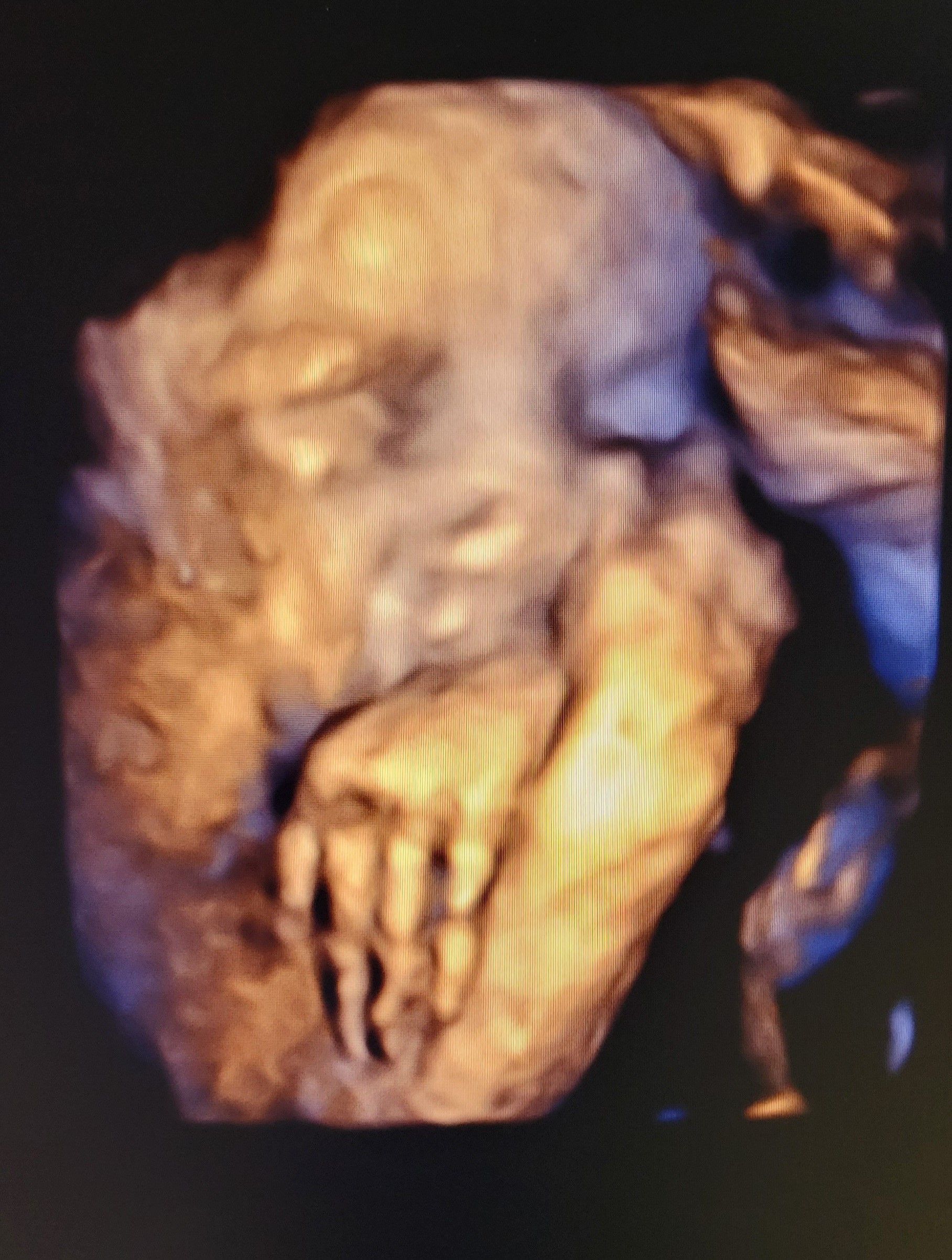 Sleeping Baby— Middletown, NY — LAFS Ultrasound