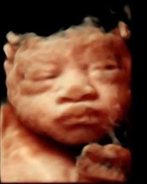 Baby Image — Middletown, NY — LAFS Ultrasound