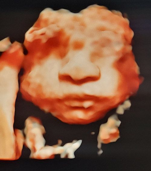 Ultrasound — Middletown, NY — LAFS Ultrasound