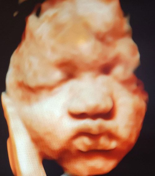 Ultrasound for Pregnancy — Middletown, NY — LAFS Ultrasound