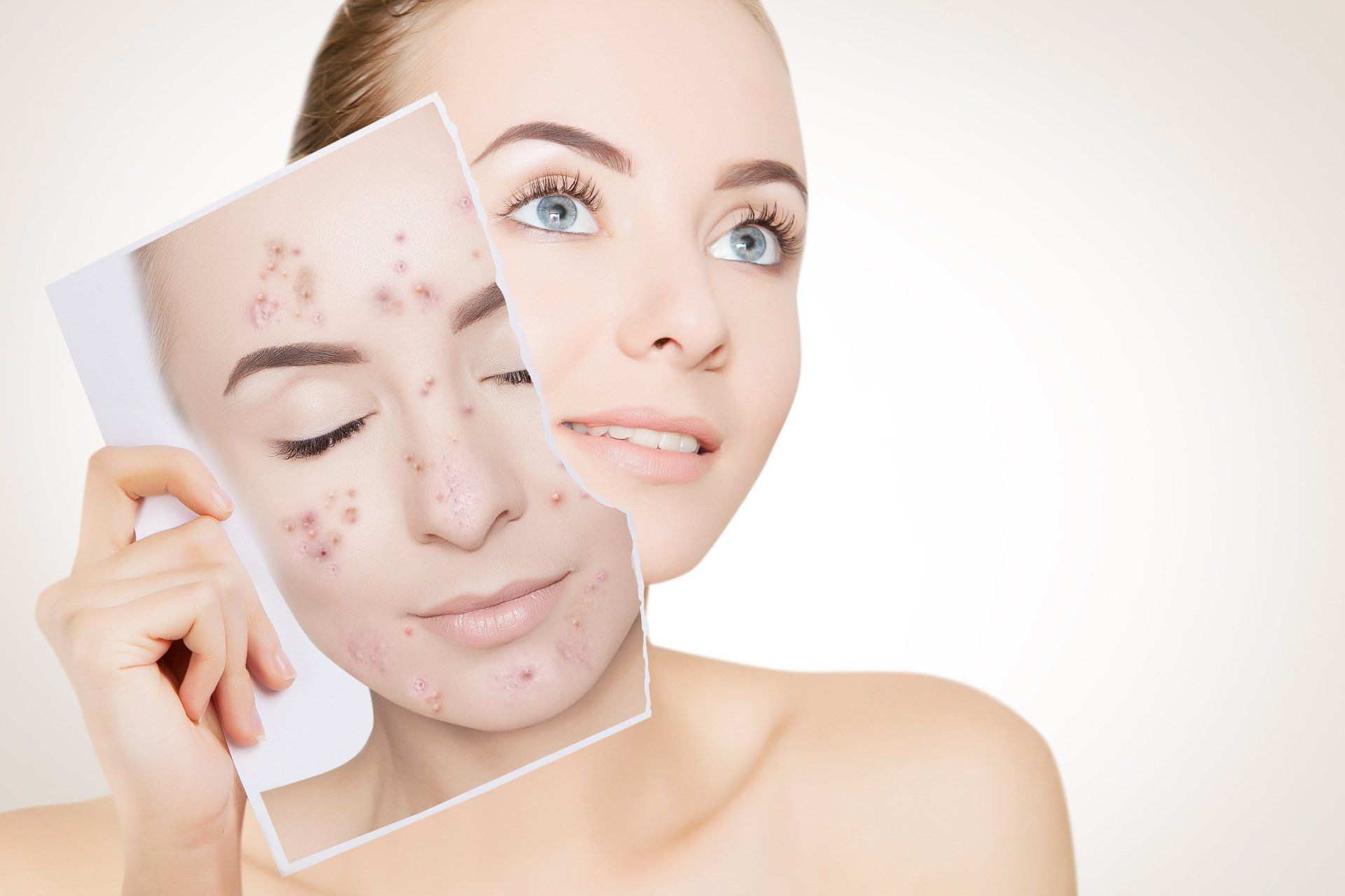 Adult skincare dermatology