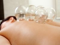 What Is Cupping Therapy